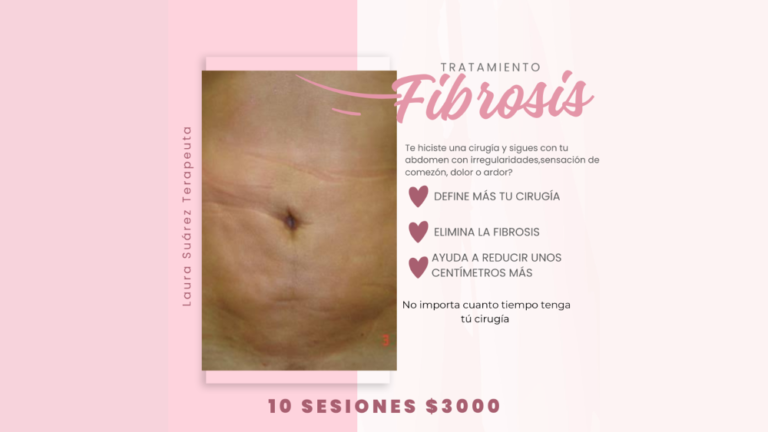 Diapositiva2 2 768x432